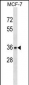 TOR1A Antibody (C-term)