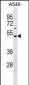 HAUS8 Antibody (N-term)