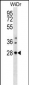 THAP10 Antibody (N-term)