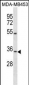 OSTM1 Antibody (C-term)