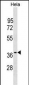 OCIAD1 Antibody (C-term)