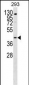 GPR172B Antibody (Center)