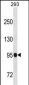 SFMBT1 Antibody (N-term)