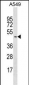 GYG2 Antibody (C-term)