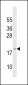 GAGE3 Antibody (N-term)