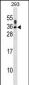 SSX5 Antibody (N-term)