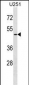 ARMCX3 Antibody (C-term)