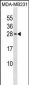 PIN4 Antibody (N-term)