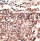 SCDGFB Antibody (Center)