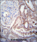 SCDGFB Antibody (Center)