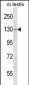 TBC1D2 Antibody (Center)