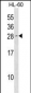 Mouse Cdkn1b Antibody (N-term)