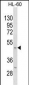 Mouse Kcnj11 Antibody (N-term)