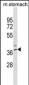 Mouse Kcnj11 Antibody (N-term)