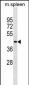 Mouse Slc10a2 Antibody (N-term)