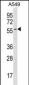 ESAM Antibody (C-term)