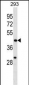 EGLN1 Antibody (C-term)