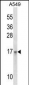 EMP3 Antibody (C-term)