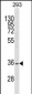 SSBP2 Antibody (N-term)