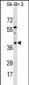 ARMC10 Antibody (N-term)