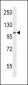 SDCCAG1 Antibody (N-term)