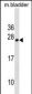 TPD52L1 Antibody (N-term)