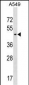 AGPAT5 Antibody (N-term)