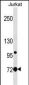 LCP1 Antibody (Center)