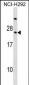 RARRES3 Antibody (Center)