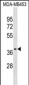 P2RX3 Antibody (C-term)