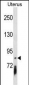 PCDHGB4 Antibody (Center)