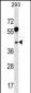 RRAGB Antibody (N-term)