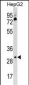 Mouse Cdk6 Antibody (C-term)