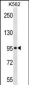 ABI3BP Antibody (Center)