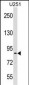 PES1 Antibody (C-term)