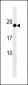 GAGE12F / GAGE12G / GAGE12I Antibody (N-term)