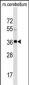 SLC25A20 Antibody (C-term)