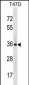 BCL2L12 Antibody (N-term)