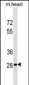 HOXB13 Antibody (C-term)