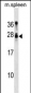 Mouse Tusc1 Antibody (Center)