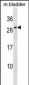 Mouse Il27 Antibody (Center)