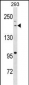 BAZ1B Antibody (N-term)