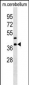 Mouse Crkl Antibody (C-term)