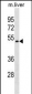 Mouse Tacstd2 Antibody (C-term)