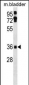 Mouse Ei24 Antibody (C-term)