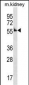 Mouse Ccna1 Antibody (Center)