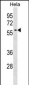 Mouse Selenbp1 Antibody (C-term)