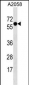 SYT4 Antibody (N-term)