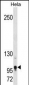 Mouse Tshz1 Antibody(Center)