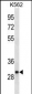 VAPA Antibody(C-term)